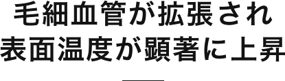 毛細血管が拡張され、表面温度が顕著に上昇